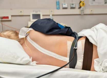 Epidural anesthesia explained – through the eyes of a birthing woman